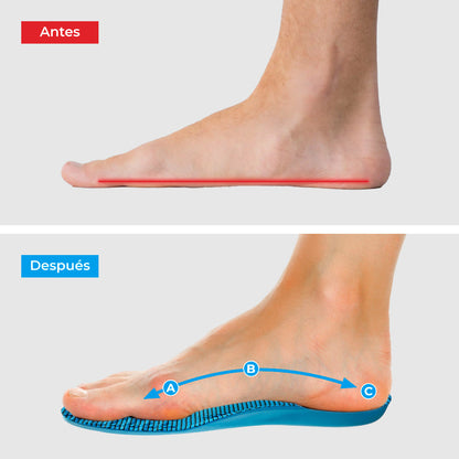 Wkładki VELQIO™️ – Ciesz się dniami wolnymi od bólu, bez kosztownych zabiegów czy wizyt u lekarza...